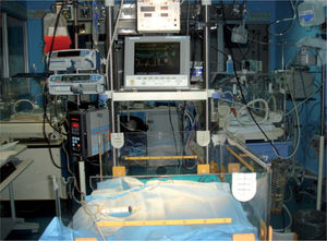 Puesto de cuidados intensivos neonatales montado para realizar exanguinotransfusión.