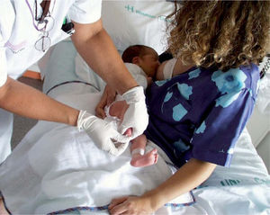 Punción del talón en el recién nacido durante la toma de pecho.