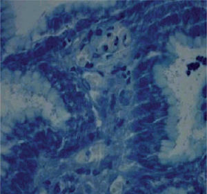 Presencia de formas bacilares de Helicobacter pylori en el moco gástrico.