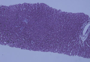 HE×20. Cierta nodularidad del tejido hepático asociado a ausencia de fibrosis.