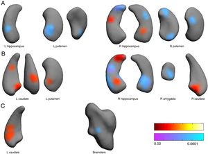Associations between subcortical nuclei shape and pain scores at the anesthesia (A), pain (B) and analgesia (C) stages. Red color indicates surface positively related to pain scores. Blue colors indicated surface negatively associated to pain scores. L: left hemisphere, R: right. Color bars indicated p-values (red-yellow for positive and blue-violet for negative relationships).