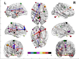 Network analysis between both groups. Colors represent the Yeo et al. (2011) networks, following their legend. Purple represents the ROIs included in the VN; blue represents the ROIs included in the SMN; green represents the ROIs included in the DAN; light purple represents the ROIs included in the VAN; yellow represents the ROIs included in the LN, orange represents the ROIs included in the FPN; red represents the ROIs included in the DMN; and black represents the ROIs not belonging to Yeo