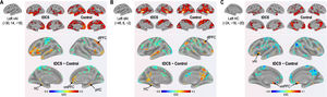 Functional connectivity differences derived from the left vAI (A), dAI (B), and HC (C). Compared to the control group, the tDCS group exhibited increased functional connectivity among fear-related brain regions (the left vAI, dAI, HC, vmPFC, and dlPFC).