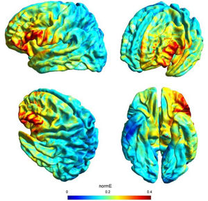 Electric field modeling for the F3/right shoulder tDCS montage. Simulation was performed with SimNIBS 3.2.