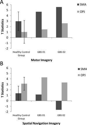A. The patterns of activation in the regions-of-interest in the motor imagery task for both GBS patients and healthy controls. The error bars reflect the standard deviation of the healthy group. SMA = supplemental motor area, OPJ = occipito-parietal junction. B. The patterns of activation in the regions-of-interest in the spatial navigation task for both patients, and healthy controls. The error bars reflect the standard deviation of the healthy group. SMA = supplemental motor area, OPJ = occipito-parietal junction.