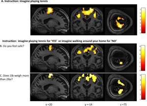 Whole-brain results from Patient 2 for the motor imagery task (A) and two communication scans (B-C). In the communication scans (B-C), the patient