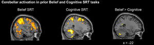 Sagittal views of cerebellar activations when participants learned the standard sequences. A prior neuroimaging study (Ma et al., 2021) showed that the Belief SRT task recruited more posterior cerebellar parts whereas the Cognitive SRT task recruited more anterior cerebellar parts. Moreover, higher posterior cerebellar Crus II activation was shown in the Belief than the Cognitive SRT task.