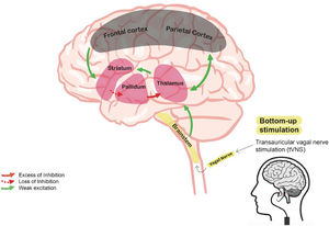 Postulated bottom-up effect influence of transcutaneous auricular vagal nerve stimulation on the mesocircuit in a severely damaged brain. The model suggests that the reduction of thalamocortical and thalamostriatal outflow following deafferentation and loss of neurons from the central thalamus withdraws important afferent drive to the medium spiny neurons of the striatum (green lines). Loss of active inhibition from the striatum (dashed red line) allows neurons of the globus pallidus interna (GPi) to tonically fire and provide active inhibition (red line) to their synaptic targets, including relay neurons of the already understimulated central thalamus, thus reducing thalamic activity and consequent thalamo-cortical connectivity. taVNS may hypothetically supply for the missing thalamic excitatory inputs by stimulating the lower and upper brainstem nuclei and thus promote the reinstatement of the thalamo-cortical connectivity. Adapted fromGiacino et al., 2014.