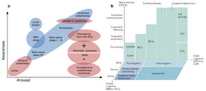 Theoretical models of consciousness. a Physiological (in blue) and pathological (in red) states of consciousness represented across the two-component scale using arousal and awareness, as presented in the initial model. Adapted from Laureys (2005), with permission. b Pathological DoC and their stages of recovery represented in a three-dimensional model including neuroimaging measures, where motor function, overt cognition and covert cognition are drawn along the axes. Reproduced from Edlow et al. (2020) with permission. REM: Rapid Eye Movement; VS/UWS: Vegetative State / Unresponsive Wakefulness Syndrome; MCS: Minimally Conscious State; (C)LIS: (Complete) Locked-In Syndrome; CRS-R: Coma Recovery Scale – Revised; CAP: Confusion Assessment Protocol; fMRI: functional Magnetic Resonance Imaging; EEG: Electroencephalography.