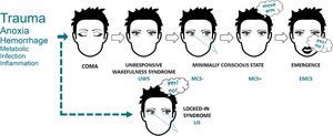 The behavioral classification of DoC. The most commonly observed etiologies are identified on the left side, with text size corresponding to approximate relative frequency in the DoC population. Illustrative cognitively mediated behaviors are pictured for MCS- (visual fixation), MCS+ (command-following) and EMCS (functional communication). LIS (illustrated with communication based on eye movements) is not a DoC but can often be misdiagnosed as such, and must always be excluded in unresponsive patients. Adapted from Wislowska et al. (2017), under the terms of CC BY Attribution License.