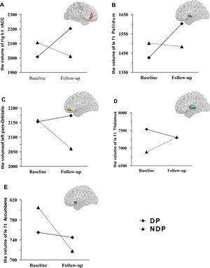 Volume alterations after risperidone treatment. Significant interaction effects of groups by time in the right rostral anterior cingulate (A), left pallidum (B), left pars orbitalis (C), left thalamus (D) and left accumbens (E) were found in volume alterations after treatment.
