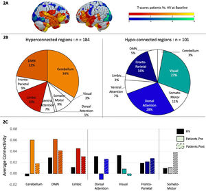 A. Two-sample t-test comparing task-related functional connectivity between patients and healthy volunteers at baseline. Hot colors indicate hyper-connectivity in patients and cold colors indicate hypo-connectivity. B. Repartition of the brain regions showing hyperconnectivity (in hot colors on the left side) or hypo-connectivity (in cold colors on the right side) across brain networks, as defined by the Yeo atlas. C. Average connectivity across each brain networks between healthy volunteers in black, patients before treatment in solid color and patients in dashed colors.