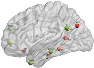 The 11 ROIs of the DMN subsystem (depicted with BrianNet viewer (Xia et al., 2013)), Red: Medial temporal lobe; Green: dorsal medial prefrontal cortex; Yellow: Midline core.