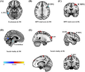 Activations in the brain regions as responses to the immediate- and delay-loss magnitude associated with HPT. Neural responses to the immediate-loss magnitude (IM) were negatively correlated with Excitement (A), Social vitality (D), and the total scores of HPT (B) whereas the delay-loss-related (DL) neural responses were positively correlated with Social vitality (E) and the HPT total scores (C).