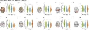 Group differences in the temporal correlation coefficients of network topological properties and schematic of brain network connectivity. A: whole-brain; B: default mode network (DMN); C: cognitive control network (FPN); D: sensorimotor network (SMN); E: visual network (VIS); F: subcortical network (SUB); G: cingulo-opercular network (CON); H: salience network (SAN); I: attention network (ATN) and J: auditory network (AUD). MDD-CT, MDD with childhood trauma; MDD-nCT, MDD without childhood trauma; HCs, healthy controls. Means and standard deviations are depicted. *: p < 0.05. **: p < 0.01, ***: p < 0.001.