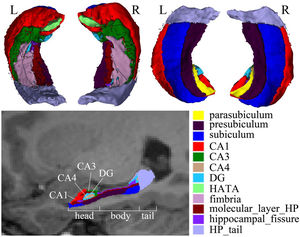FreeSurfer7.3.2 output showing hippocampal substructure. Top row shows 3D model of the different segmented hippocampal subfields with bottom and top views on the segmented hippocampus (color legend of individual subfield segments on bottom right); the bottom row shows the relation of these original FreeSurfer 7.3.2 hippocampal subfields to functional models separating the hippocampus into a model grouping cornu ammonis (CA) and dentate gyrus (DG) within the head-body-tail separation.
