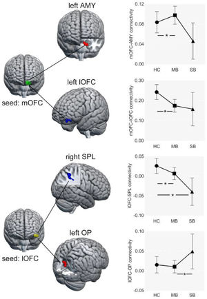 Resting-state functional connectivity seeded from medial and lateral OFC.