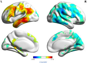 Neural response to stress induction in the ScanSTRESS paradigm.