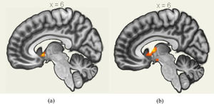 (a) The activated brain clusters by value affirmation during stress; (b) The activated brain clusters by emotional support during stress.