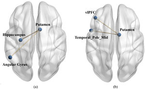 The functional connectivity between putamen and stress brain area during stress. (a) Compared to non-reward, value affirmation induced stronger functional connectivity of putamen with the left Angular gyrus (MNI-51 −51 36, t = 7.42) as well as the left hippocampus (MNI −30 −15–15, t = 4.19). (b) compared to non-reward, emotional support induced stronger functional connectivity of putamen with the left vlPFC (Frontal_Inf Orb_L, MNI −42 36 −15, t = 4.46) as well as the left temporal pole mid (MNI −51 9 −27, t = 5.17).