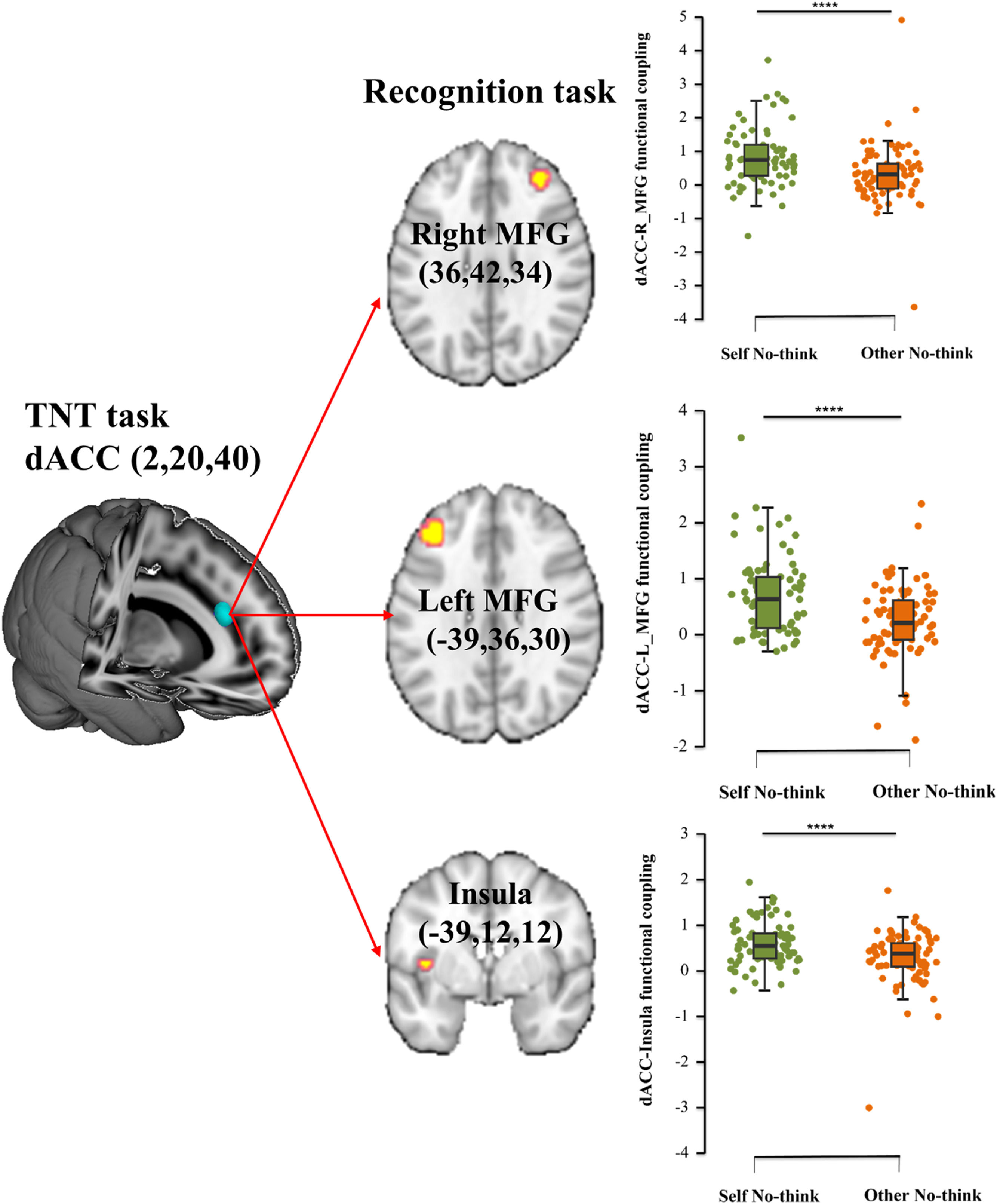Neural underpinnings of a two-phase memory suppression process in the ...