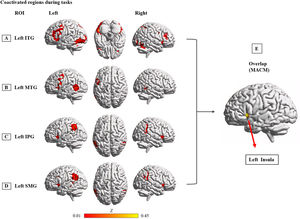 Interconnected brain network of common hypoactivation regions. Note: MACM results display brain regions that are coactivated with the left ITG (A), MTG (B), IPG (C) and SMG (D) in task-based activation studies of healthy participants from the BrainMap database, as well as a conjunction (E) across all 4 MACM maps. Coordinates reported in Montreal Neurological Institute space. Abbreviation: IPG: inferior parietal gyrus; ITG: inferior temporal gyrus; MACM: meta-analytic connectivity modeling; MTG: middle temporal gyrus; SMG: supramarginal gyrus.