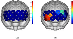 (A) p-values for group differences in cortical activation across each channel of in pre-intervention. (B) the p-values in post-intervention.