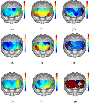 (A) Mean Oxy-Hb changes of linear group in pre-intervention. (B) Mean Oxy-Hb changes of linear group in post-intervention. (C) p-values of each channel for pre- and post- comparison in linear group. (D) Mean Oxy-Hb changes of loop group in pre-intervention. (E) Mean Oxy-Hb changes of loop group in post-intervention. (F) p-values of each channel for pre- and post-comparison in loop group. (G) Mean Oxy-Hb changes of control group in pre-intervention. (H) Mean Oxy-Hb changes of control group in post-intervention. (I) p-values of each channel for pre- and post-comparison in control group.