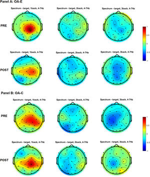 Topographical distribution of the theta power for three levels of n-back task difficulty in the older and young adult age groups in the pre-test and the post-test. Note. All plots provide the topographical distribution of the theta power (μV2) according to the level of the task difficulty. The top three plots show the distribution of the theta power for 1-back, 2-back, and 3-back tasks obtained in the pre-test, labeled as “PRE.” The bottom three plots show the distribution of the theta power for 1-back, 2-back, and 3-back tasks obtained in the post-test, labeled as “POST”. Panel A shows the distribution of the alpha power in experimental group of older adults, labeled as “OA-E”. Panel B shows the distribution of the alpha power in control group of older adults, labeled as “OA-C”. Panel C shows the distribution of the alpha power in experimental group of young adults, labeled as “YA-E”. Panel D shows the distribution of the alpha power in control group of young adults, labeled as “YA-C”.