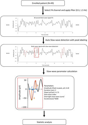 Overview of the slow wave analysis process, including data acquisition, automatic detection, parameter calculation, and statistical analysis.