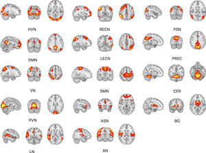 Resting-state networks identified through ICA (HVN – higher visual network; DMN – default mode network; VN – visuospatial network; PVN – primary visual network; LN – language network; RECN – right executive network; LECN – left executive network; SMN – sensorimotor network; ASN – anterior salience network; AN – auditory network; PSN – posterior salience network; PREC – precuneus; CER – cerebellum; BG – basal ganglia).