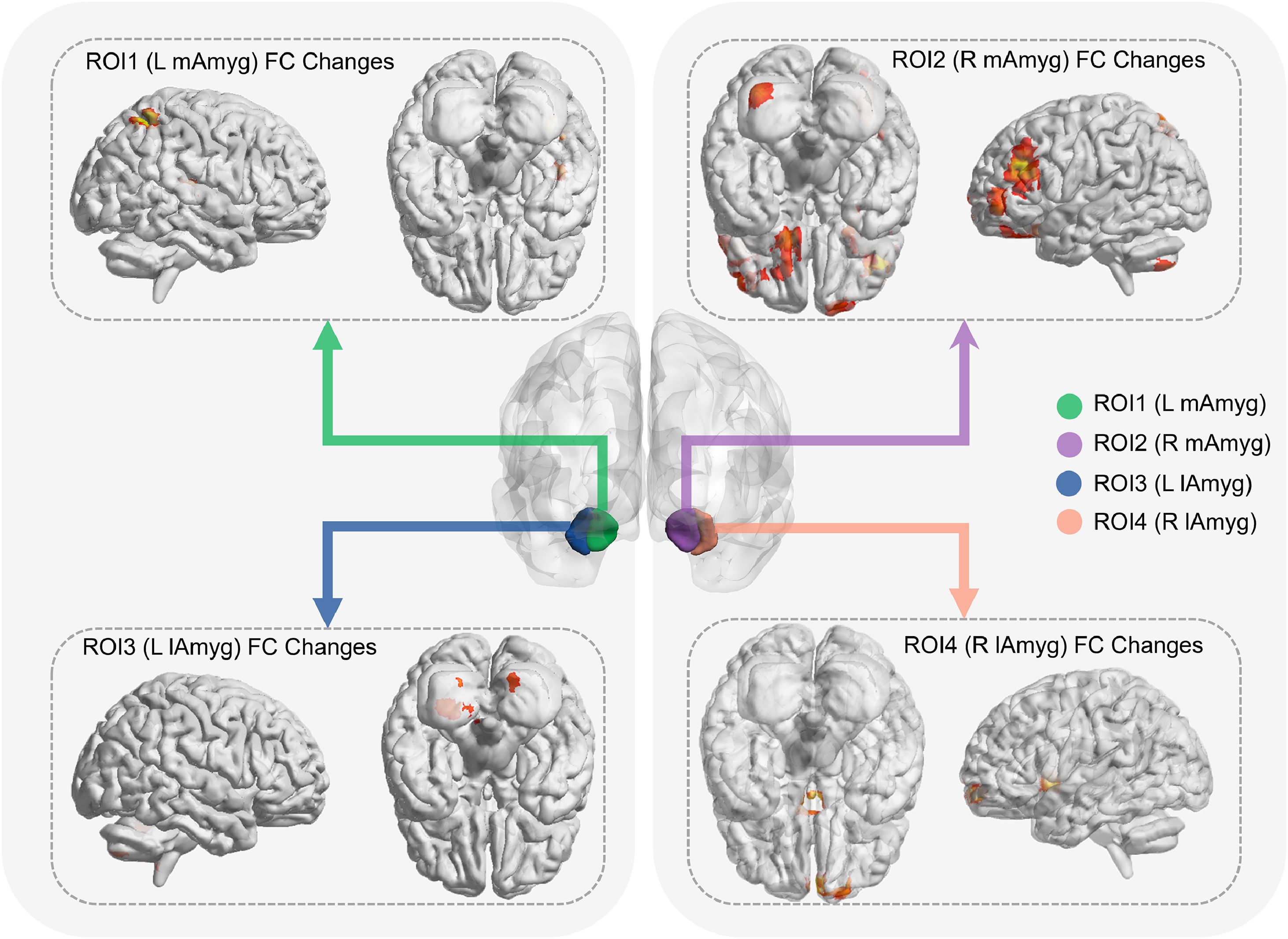 Boosting your mood: How exercise and the amygdala dance together ...