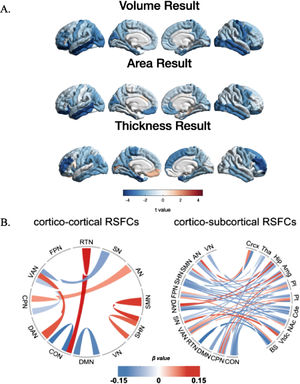 The association results between SMA and brain developmental pattern. A. The association between SMA usage and brain morphology, including cortical volumes, area and thickness. Only significant brain regions are displayed in colour. B. Left is the associations between SMA and RSFCs among 12 cortical networks [auditory network (AN), visual network (VN), sensorimotor hand network (SHN), sensorimotor mouth network (SMN), cingulo-opercular network (CON), cingulo-parietal network (CPN), dorsal attention network (DAN), default mode network (DMN), fronto-parietal network (FPN), retrosplenial temporal network (RTN), salience network (SN), ventral attention network (VAN)]. Right is the associations between SMA and cortico-subcortical RSFCs [10 subcortical regions including cerebellum cortex (Crcx), thalamus (Tha), Hippocampus (Hip), amygdala (Amg), Putamen (Pt), pallidum (Pl), caudate (Cde), nucleus accumbens (NAc), ventral diencephalon (Vtcd) and brainstem (BS)]. (pfdr < 0.05).