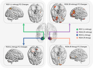 Effects of acute aerobic exercise on amygdala subregion functional connectivity. The figure illustrates brain regions showing a significant Group (Exercise vs. Control) × Time (Pre- vs. Post-intervention) interaction on resting-state functional connectivity (rs-FC), seeded from four distinct amygdala subregions. The central panel shows the four seed ROIs: left medial amygdala (L mAmyg, ROI1), right medial amygdala (R mAmyg, ROI2), left lateral amygdala (L lAmyg, ROI3), and right lateral amygdala (R lAmyg). Arrows indicate the corresponding rs-FC interaction results for each seed, displayed on sagittal and axial views of a standard brain template. Warm colors (red to yellow) represent clusters where the exercise group showed a significantly greater increase in FC compared to the control group. The statistical maps are thresholded at a voxel-level p < 0.005 and a cluster-level p < 0.05, corrected for multiple comparisons using Gaussian Random Field (GRF) theory.