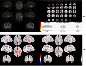 A: Significant brain regions in the functional connectome, B: Seed-to-voxel associations in the Response/Non-response groups.