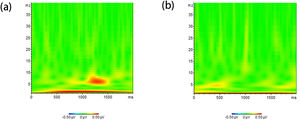 Differences in the theta band power in the experimental group (a) and in the control group (b) before and after tDCS intervention.