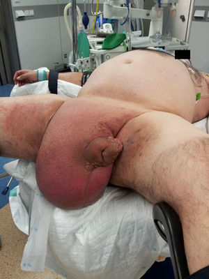 Paciente en posición de litotomía.