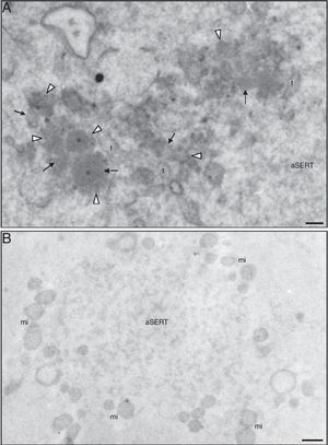 Ultrastructure of a morphological normal human mature metaphase-II oocyte. (A) Detection of calcium. There are no antimonate deposits in small vesicles (*), in associated tiny vesicles (white arrowheads), in dense materials (arrows) either associated with small vesicles or in aggregates impregnated with tiny vesicles and in SER tubules (t). (B) Control of calcium detection. No antimonate deposits are observed in aSERT or in the associated mitochondria (mi). Bars: (A) 0.1μm; (B) 0.5μm.