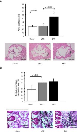 Effects of subtotal nephrectomy (SNX) vs unilateral nephrectomy (UNX) on vascular calcification in the aortic root and the cavernosal bodies in male apolipoprotein E deficient mice. (A) Upper panel: SNX animals showed a significant increase in vascular calcification in the aorta when compared with controls. Lower panel: Representative findings of calcification in the aortic root in the 3 study groups. Note the 3 aortic valves, cut in a perpendicular position to obtain a perfect image. Calcification is marked in black. Magnification 2.5×. (B) Upper panel: SNX and UNX mice showed a significant increase of calcification score in the cavernosal bodies when compared with controls. Control (n=15), UNX (n=11), and SNX (n=12). Values are means±standard error of the mean. Lower panel: Representative findings of calcification in the cavernosal bodies. Magnification 10×.