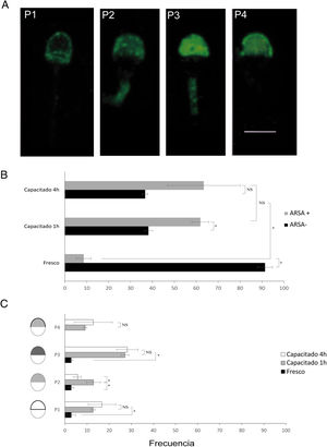 A)Patrones de fluorescencia observados: marcaje en la banda ecuatorial y zona periacrosomal (P1), fluorescencia tenue en la región acrosómica (P2), fluorescencia intensa en la región acrosomal (P3), fluorescencia intensa en la región periacrosomal con un marcaje menos intenso pero homogéneo en toda la región acrosómica (P4). Escala de 10μm común a todas las imágenes. B)Frecuencia de células con y sin inmunofluorescencia para ARSA (ARSA+, ARSA−) en cada condición fisiológica. C)Frecuencia de patrones de ARSA en espermatozoides humanos que presentaron inmunofluorescencia para ARSA (ARSA+) en diferentes condiciones fisiológicas. * Diferencias significativas en p<0,05. NS: diferencias no significativas.