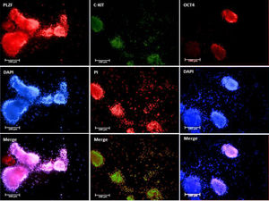 Identification of isolated SSCs was confirmed by Immunofluorescence staining of PLZF, C-KIT and OCT-4 proteins in Colonies derived from SSCs culture on day 7th. The most of SSCs derived colonies have positive reaction to PLZF, C.KIT and OCT-4 anti-bodies.