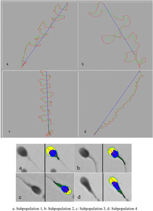 Motility trajectory and morphometric examples of subpopulations.