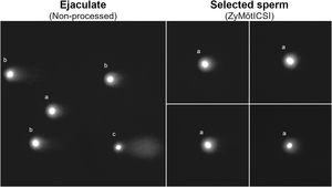 Microscopic images of the Neutral Comet assay performed on sperm from the raw semen sample (ejaculate) and selected sperm filtered using the ZyMōtICSI MSS device. a Indicates sperm with intact DNA; b Indicates sperm with fragmented DNA; c Indicates sperm with highly degraded DNA.