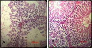 Representative photomicrographs of seminiferous tubules in rats of control group (n=20) (A); minocycline group (n=20) (B) (hematoxylin–eosin, 400×). Scale bar=0.02. (A) The epithelial structure shows a normal cell density. (B) The epithelial structure shows some positive changes such as increased seminiferous cell count as compared to control group.