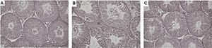 Photomicrographs of hematoxylin and eosin stained sections of testicle of rats (200×). (A) Seminiferous tubule epithelial structure was observed in normal morphology in control group and there were many matured spermium (arrowhead) in lumen. (B) In T/D group, there were many immature germinal epithelial cells (white arrow) in the lumen of the seminiferous tubule. In addition vacuolization of the tubule epithelium (double-headed arrow), and edema (star) in the peritubular connective tissue were observed. (C) In T/D+EEP group, it was observed that the seminiferous tubule structure had improved considerably compared to T/D group, the number of spermatozoa increased (arrowhead) and peritubular edema (star) decreased in the seminiferous tubules.