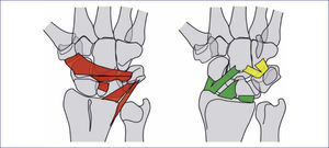 Representación de los ligamentos carpianos en función de la concentración de mecanorreceptores. Los ligamentos con gran cantidad de mecanorreceptores están representados en rojo (radiocarpiano dorsal, intercarpiano dorsal y escafolunar), los de inervación intermedia en amarillo (complejo volar piramidal-ganchoso-hueso grande) y los de baja inervación en verde (radiocarpianos volares).