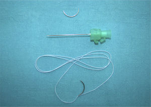 Material necesario para la técnica de sutura tendinosa «un paso, 4-hilos Kessler-Tsuge». FiberLoop® (Arthrex, Naples, FL, EE. UU.), aguja viuda, aguja intramuscular 21G.