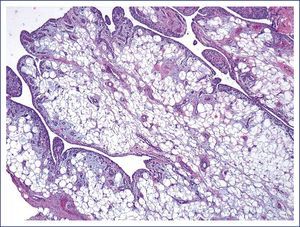 Imagen microscópica a 20 aumentos con tinción hematoxilina-eosina.