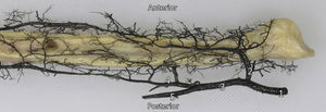 Preparación anatómica de la distribución de los vasos arteriales del peroné. 1: Arteria poplítea; 2: Arteria tibial anterior; 3: Tronco tibioperoneo; 4: Arteria peronea; 5: Arteria tibial posterior (seccionada).