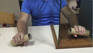 Terapia en espejo. La mano afecta se encuentra dentro de la caja e intenta reproducir los gestos que la mano sana realiza fuera de la caja y el paciente observa en el espejo.
